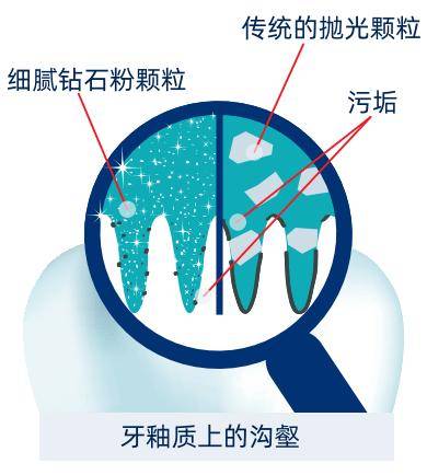 【章小蕙推荐】牙黄怎么办？瑞士怀尔德牙膏告诉你安全不伤牙的白牙方法